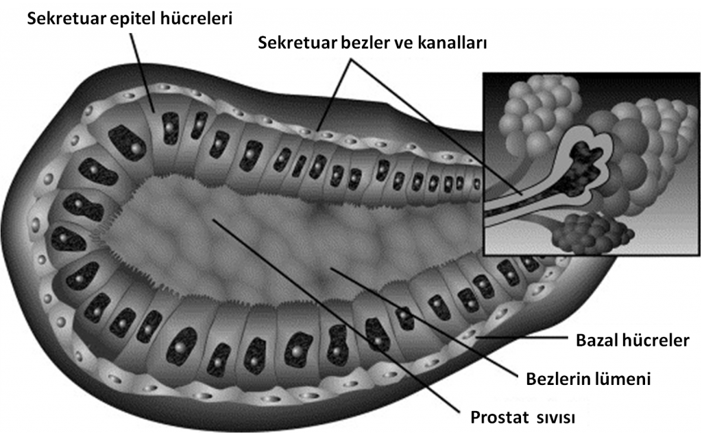 Resim-5: Prostat bezi içindeki salgı bezleri ve bunun içini döşeyen “Sekretuar Epitel Hücreleri” ile bunların dış kısmında bulunan “Bazal Hücreler”. Bazal hücreler daha salgı yapma özelliğine sahip olmayan ancak epitelyum hücreleri fonksiyonları yitirip yok olduklarında yeni Sekretuar Epitel Hücrelerini oluşturan hücre katmanıdır.