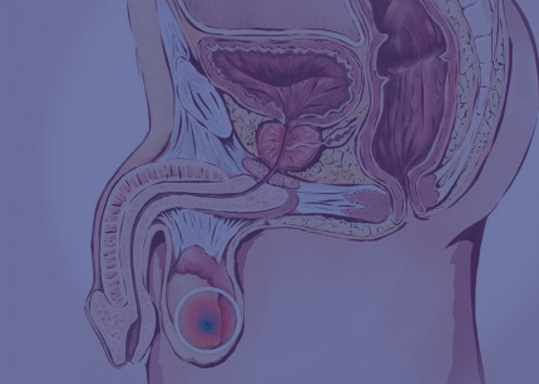 Testis Kanseri