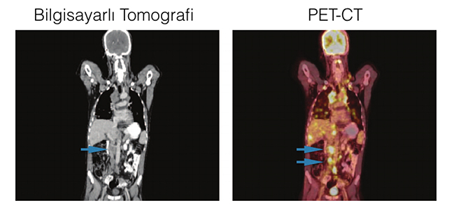 Bilgisayarlı Tomografi & PET-CT