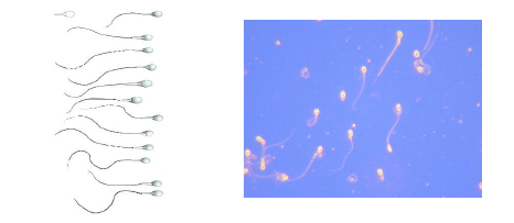 İnfertilite (Kısırlık) Tedavisi