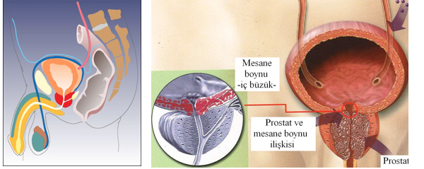 İnfertilite (Kısırlık) Tedavisi