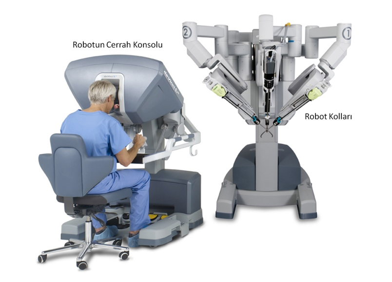 Resim-2: daVinci Robot kollarının cerrah tarafından kontrol edildiği “Konsol”