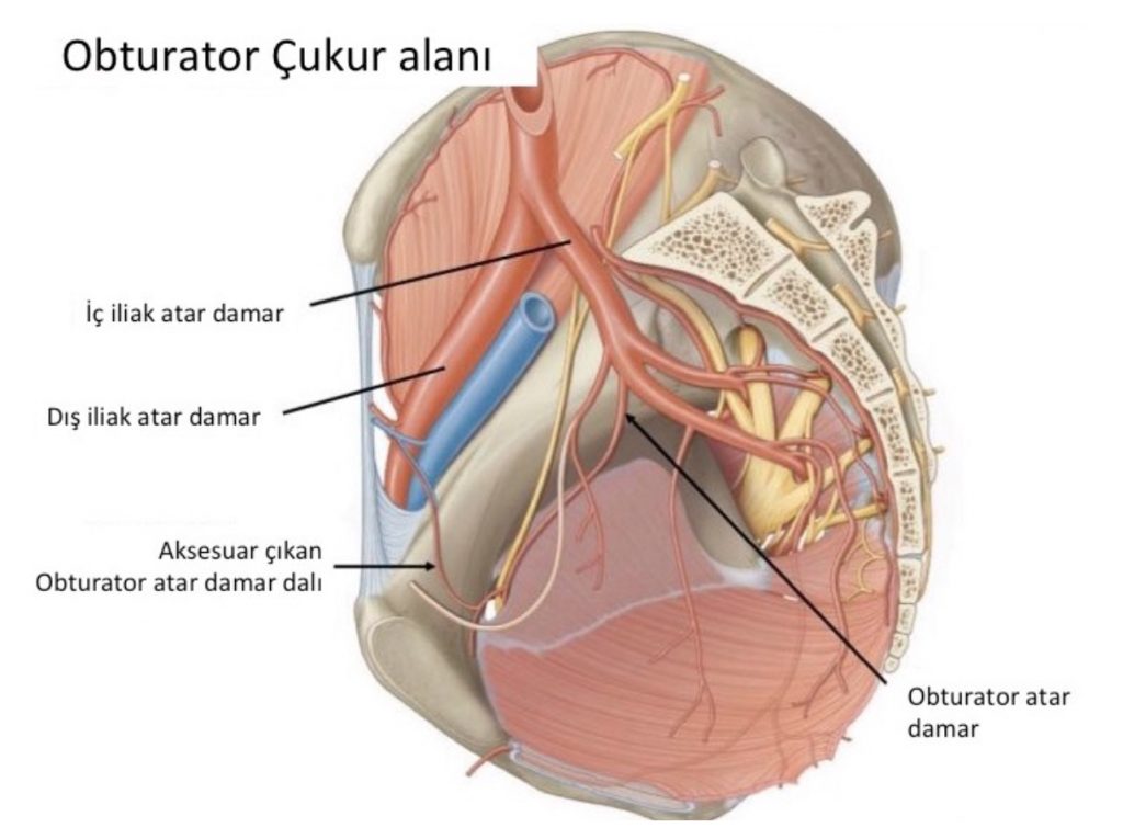 Mesane Kanseri’nde Çıkartılan Lenf Bezi Sayısı Ne Kadar Önemli?