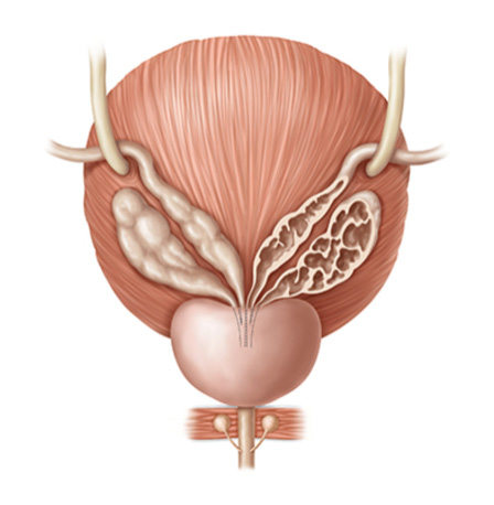 Prostat Cancer