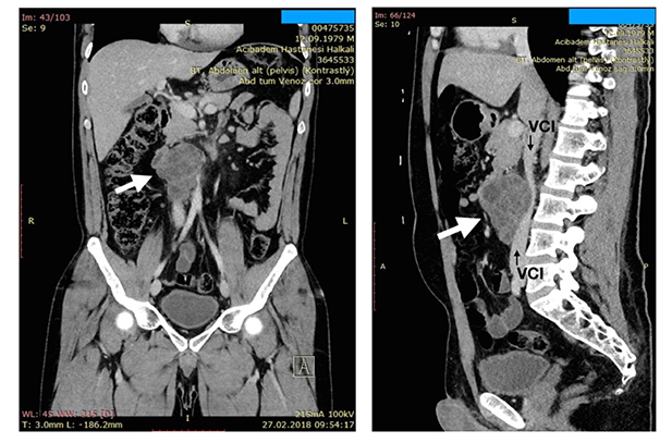 Bilgisayarlı Tomografi & PET-CT