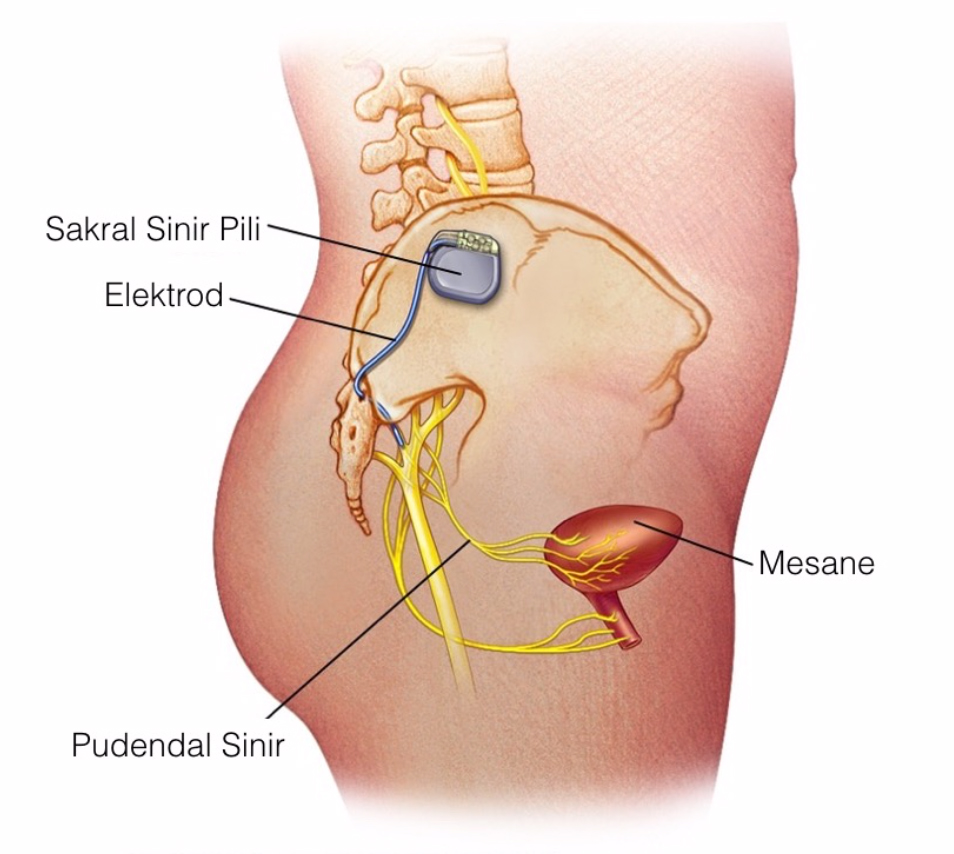 Pudendal Sinir Pili