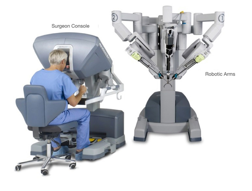 Robotic Prostate Cancer Surgery