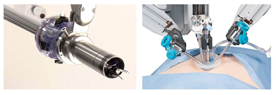 Image-3a: Appearance of the robot arms that are placed into body through belly button.