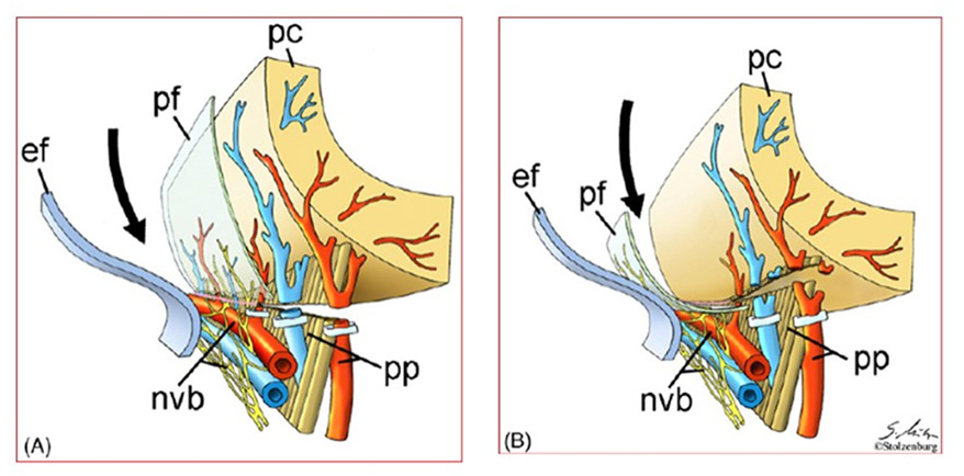 Robotic Prostate Cancer Surgery