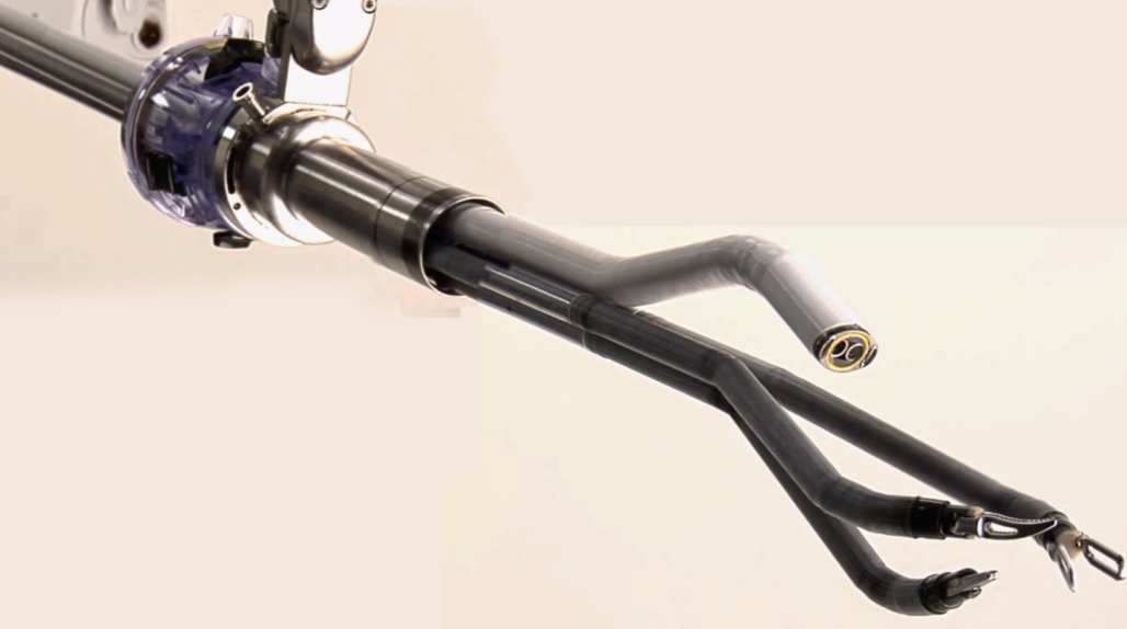 2-3 cm lik bir göbekten kesi ile 2 cm lik robot trokarı yerleştirilerek, single port robot ile bu cerrahi rahatlıkla gerçekleştirilebilir.