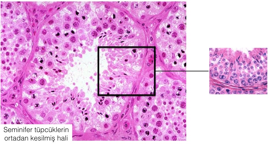 Testis Nedir? (Erbezi Nedir?)