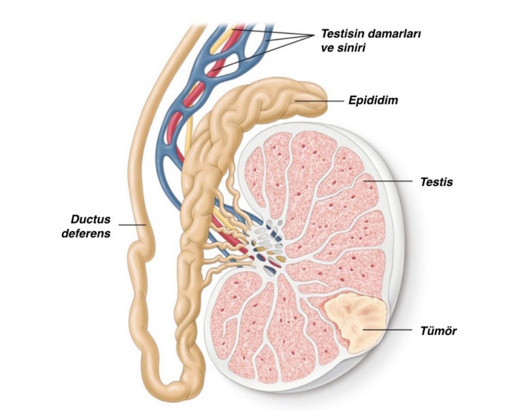 Testis Kanseri Gelişiminde Risk Faktörü ve Testis Kanseri’nde Ölüm Oranı Nedir ?