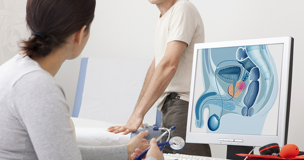 Prostat Kanserinde Yeni Tedavi Yaklaşımı