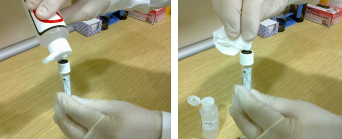 Figure 4: Cleaning the rubber stopper on the cap of the sterile vacuum-sealed tube with alcohol.